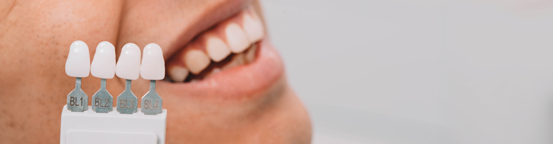 Dentist using a tooth shade guide to match veneers for a patient's smile.